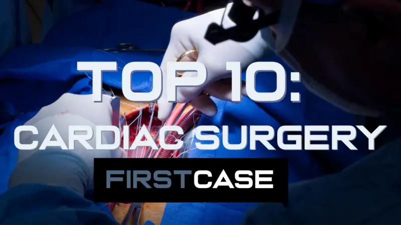 Top 10 Cardiac Surgery