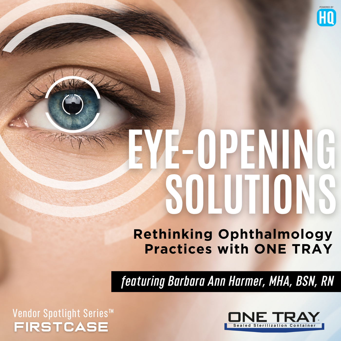 Eye-Opening Solutions: Rethinking Ophthalmology Practices with ONE TRAY