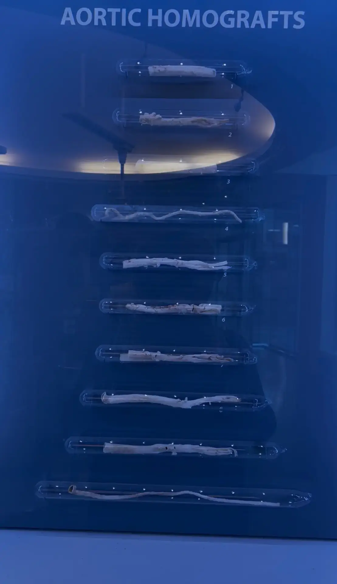 Aortic Homografts