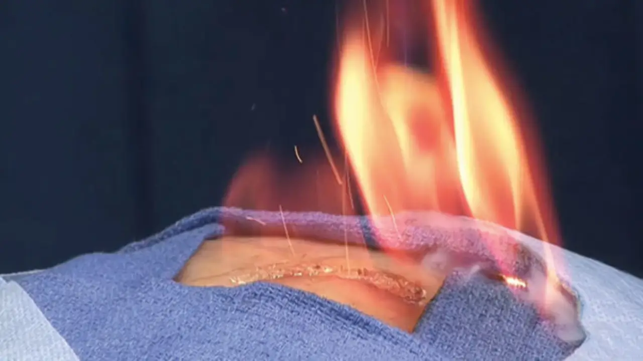 Waiting for the Prep to Dry - Why Dry Times Matter